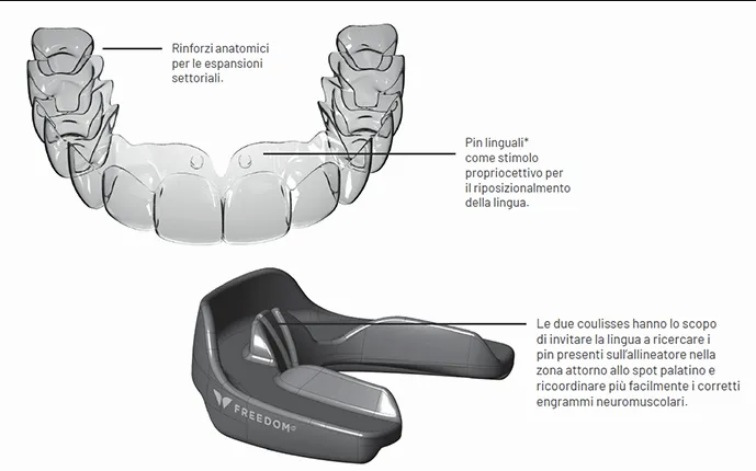 allineatori denti e attivatori